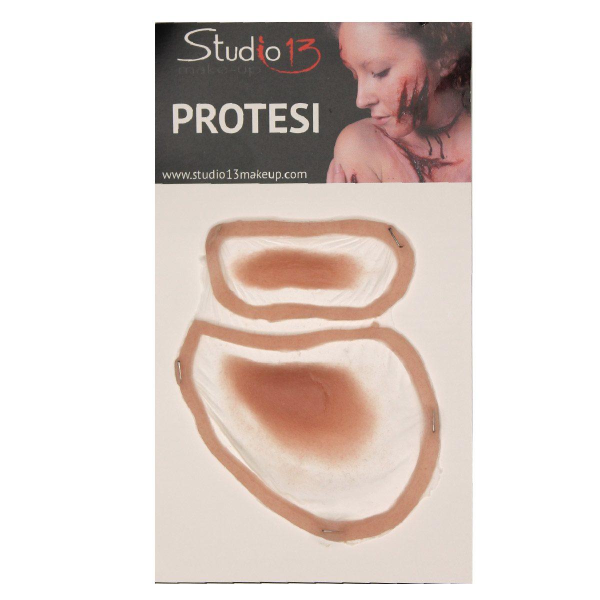 Protesi occhio gonfio sinistro