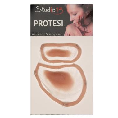 Protesi occhio gonfio sinistro