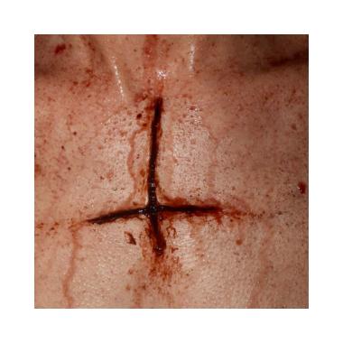 Protesi croce incisa