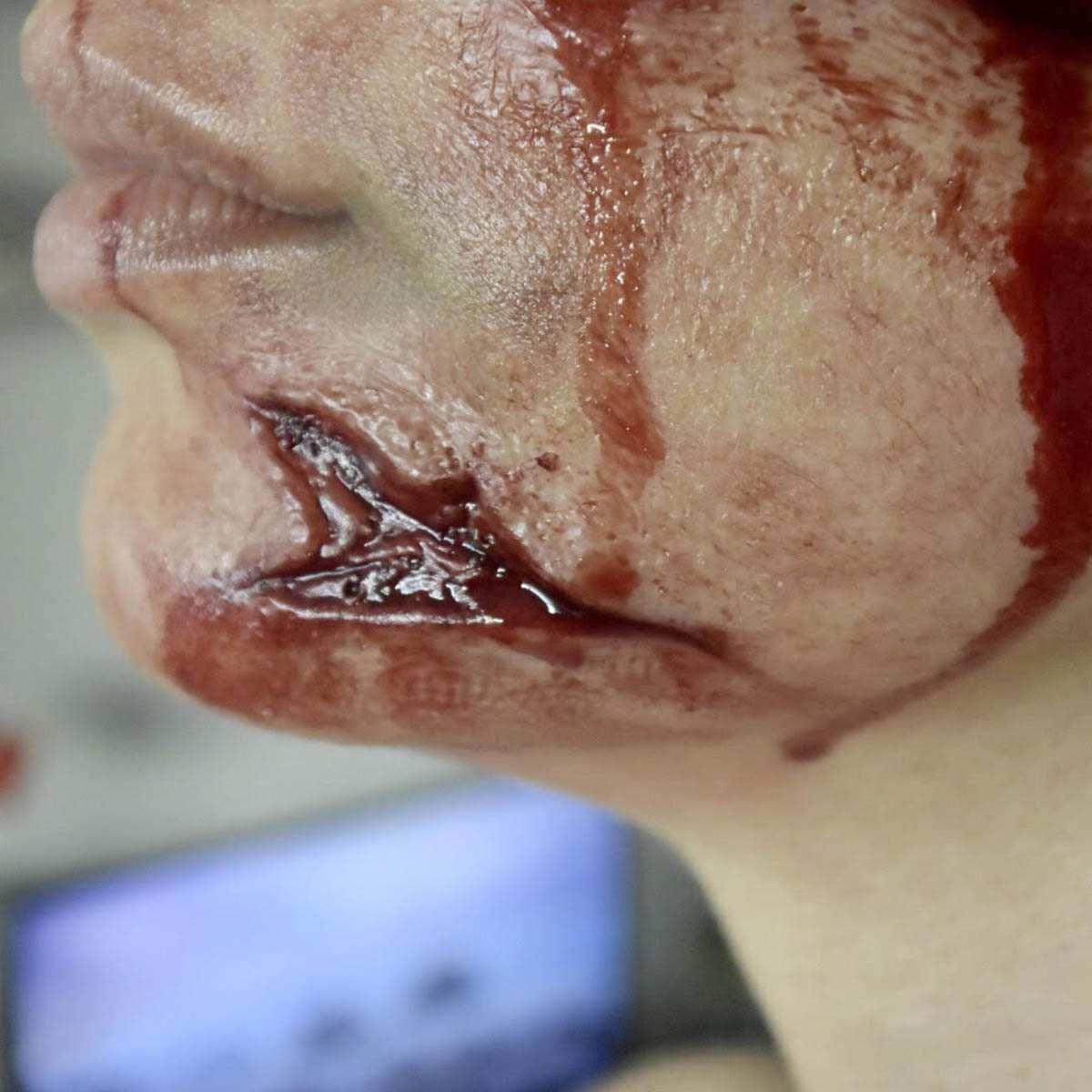 PROTESI SPACCATURA SILICONE <br />