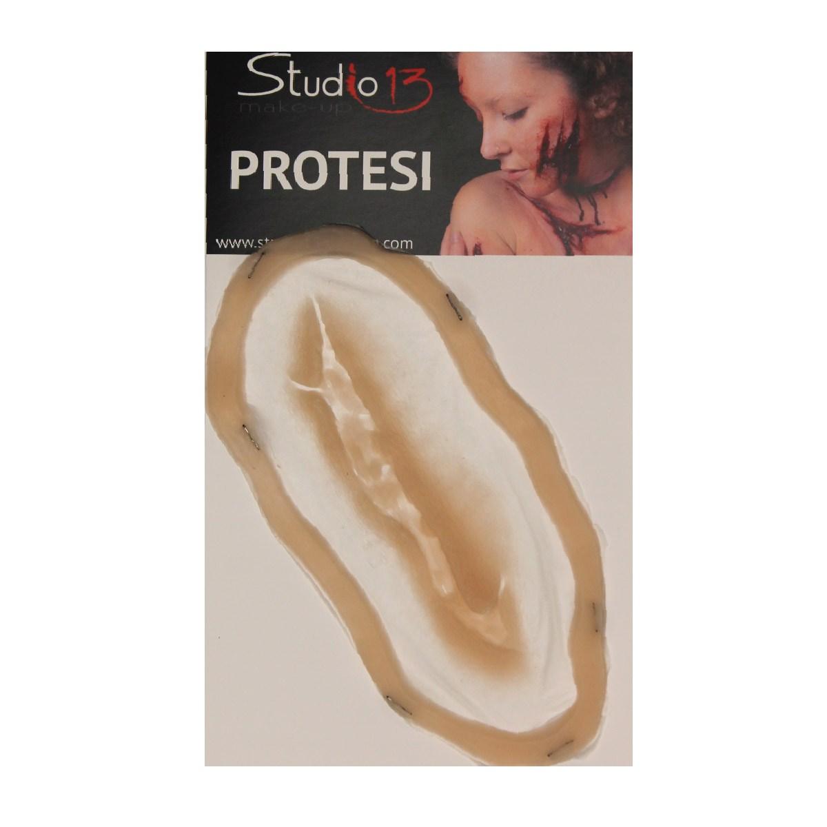 Protesi strappo silicone