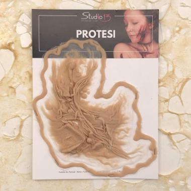 Protesi guancia infetta in silicone