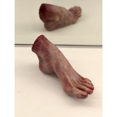 Pes-Livor | <br />Piede Livido con Discromie Post-Mortem